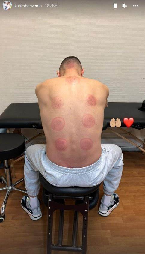 1648304560274039035.jpg 本泽马.jpg